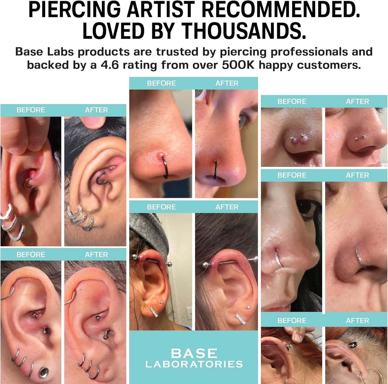 Base Labs Piercing Aftercare Kit - Bump Solution & Saline Gel, 3-Pack